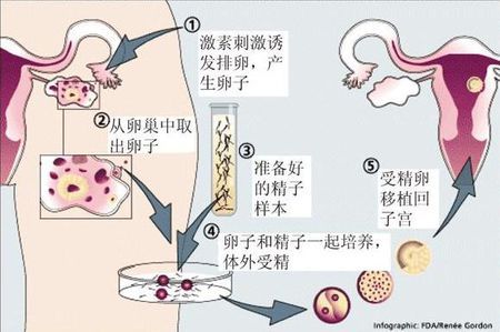 生殖医学中心